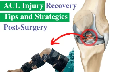 ACL Injury Recovery Tips and Strategies Post-Surgery
