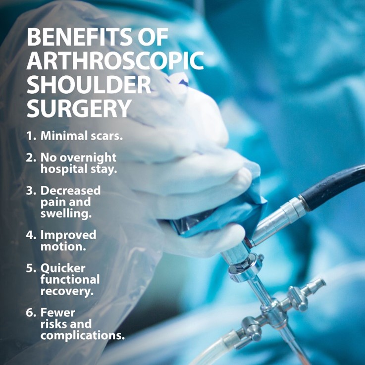 Benefits of arthroscopic shoulder surgery