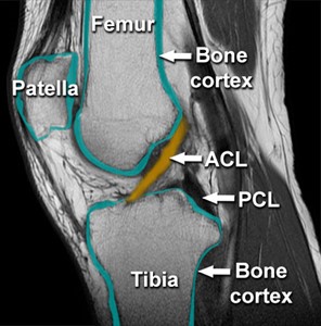 MRI of the Knee