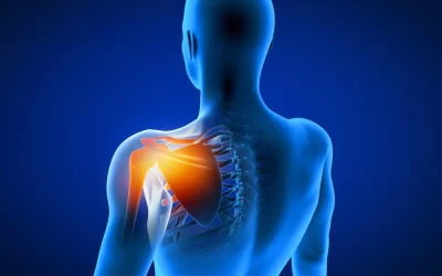 Best Frozen Shoulder Treatment Doctors in Rajajinagar, Bangalore – Orthocare Bangalore