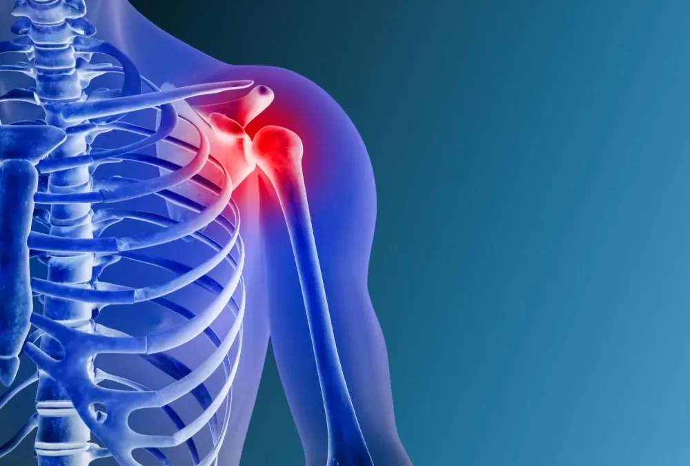 Shoulder Dislocation: Causes, Symptoms, and Advanced Treatment in Bangalore