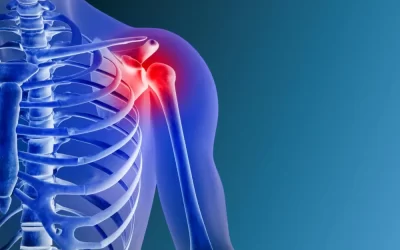Shoulder Dislocation: Causes, Symptoms, and Advanced Treatment in Bangalore
