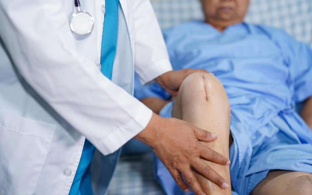  Can You Sit Cross-Legged Post Partial Knee Replacement? A Step-by-Step Recovery Guide