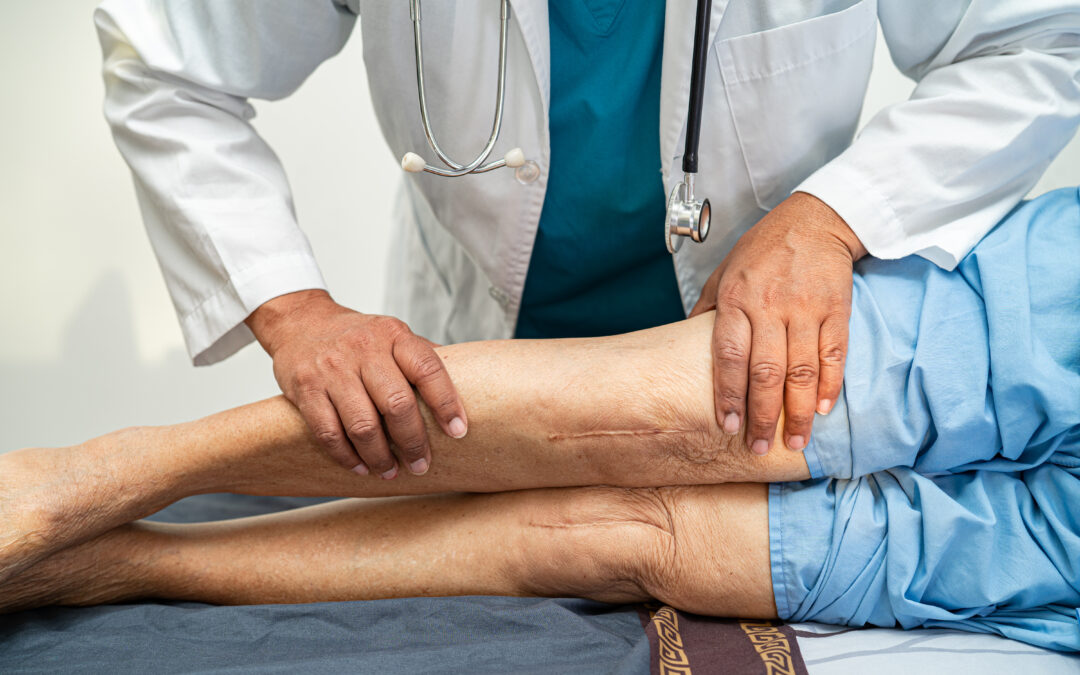 Knee Pain Treatment Without Surgery: What Actually Works, and When Rajajinagar Patients Should Consider an Operation