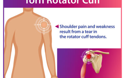 Rotator Cuff Injury Treatment in Bangalore: Complete Guide to Cost, Recovery, and Choosing the Right Surgeon